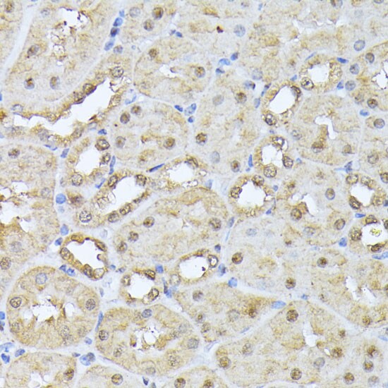 Proteasome 20S beta 3 Antibody