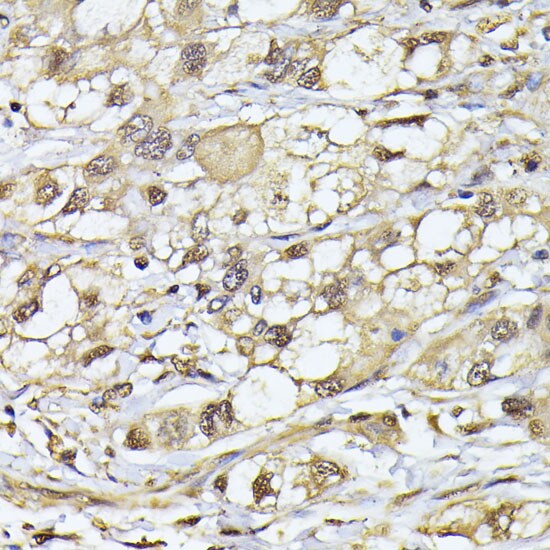 Proteasome 20S beta 3 Antibody