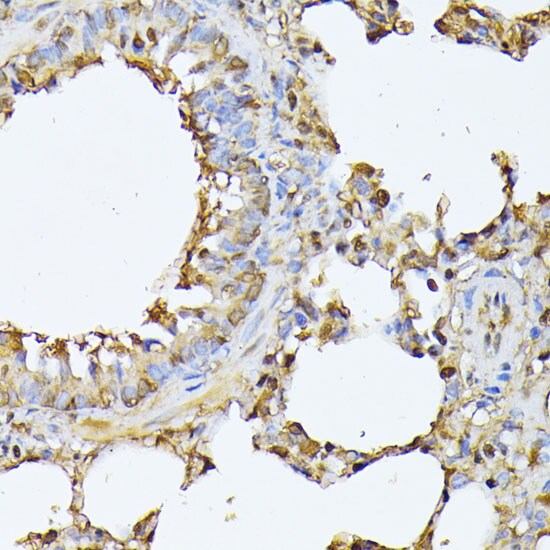 Proteasome 20S beta 3 Antibody
