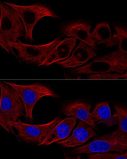 alpha Tubulin 4a Antibody