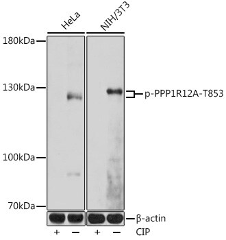 Myosin Phosphatase [p Thr853] Antibody
