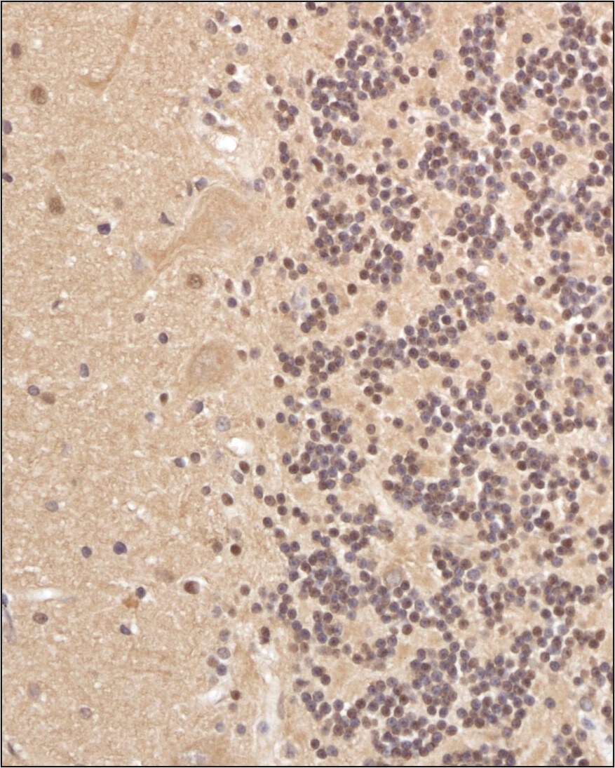 alpha Tubulin Antibody (DM1AR) Immunohistochemical Staining of alpha Tubulin in Human Brain