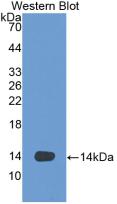 VEGF-D Antibody (2-2#)