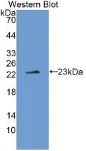 IL-37/IL-1F7 Antibody (1#)