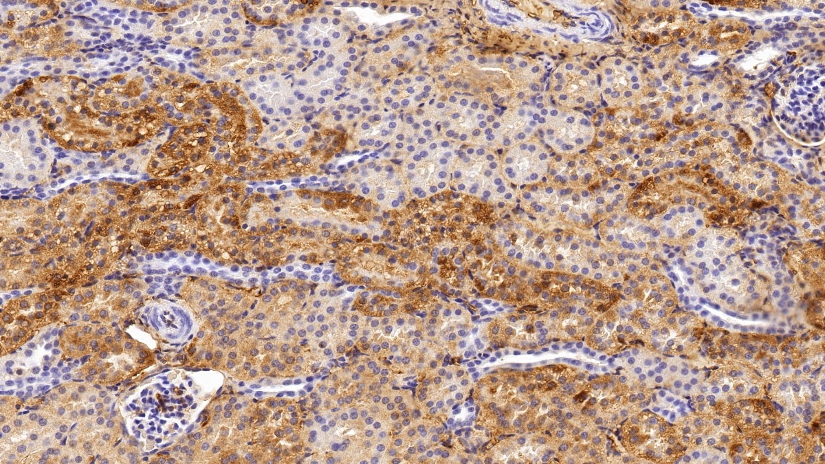 FGF acidic/FGF1 Antibody (C14)