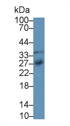 IGFBP-4 Antibody (A3)