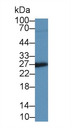 IGFBP-4 Antibody (A3)
