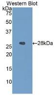 IGFBP-4 Antibody (A3)
