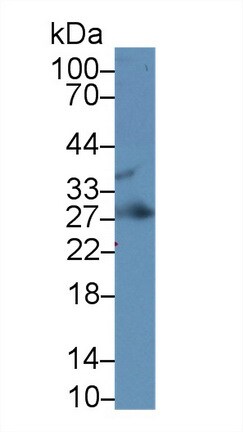 IGFBP-4 Antibody (A4)