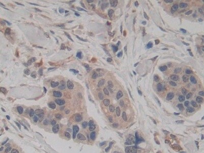 Amphiregulin Antibody (A6)