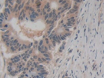 Amphiregulin Antibody (A6)