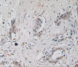 Amphiregulin Antibody (A3)