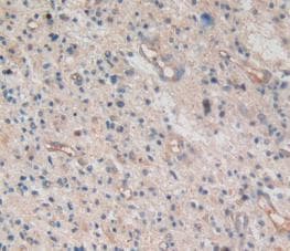 Amphiregulin Antibody (A3)