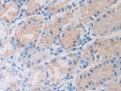 CXCL12/SDF-1 Antibody (C2)