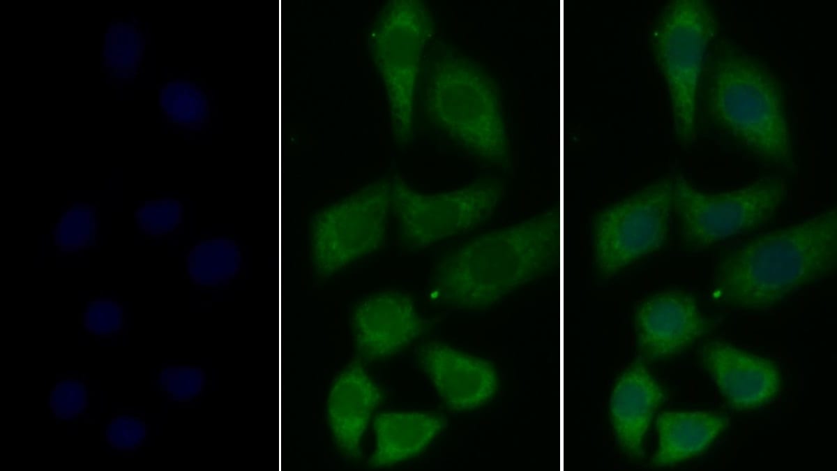 t-Plasminogen Activator/tPA Antibody (K17)