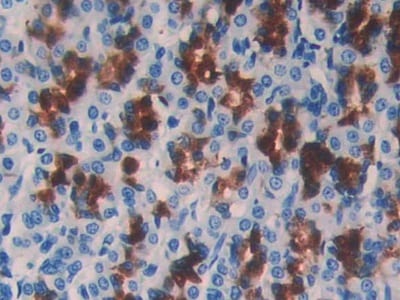 Cystatin B/Stefin B Antibody (C13)