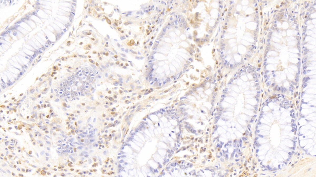 CD177 Antibody (C11)