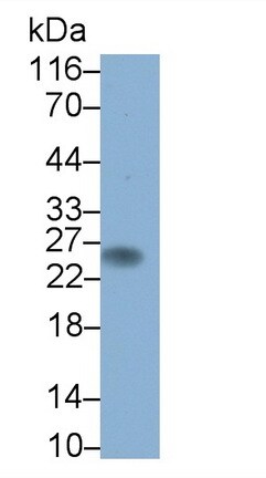 CD3 gamma Antibody (D14)