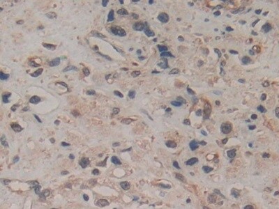 Amphiregulin Antibody (A7)