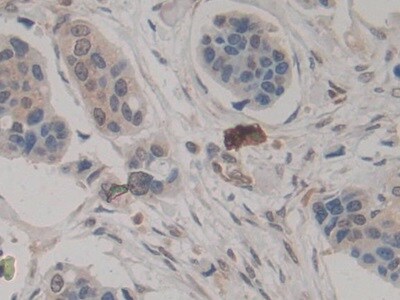 Amphiregulin Antibody (A7)