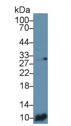 S100A6 Antibody (C2)