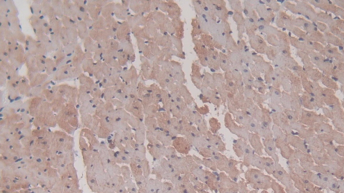 HSP20/HSPB6 Antibody (C9)