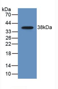 CCL22/MDC Antibody (D1)