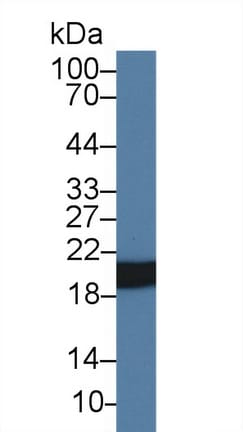 HSP20/HSPB6 Antibody (C1)