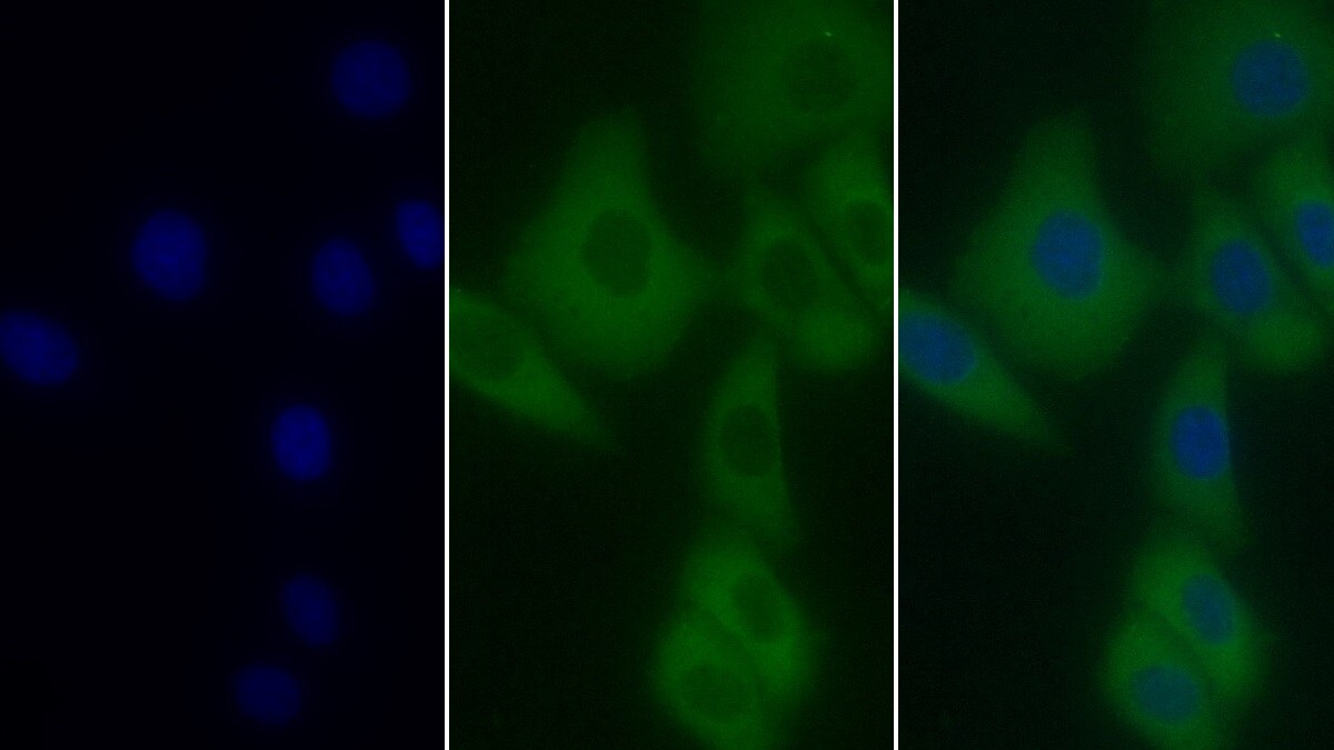 T Plastin Antibody (C2)