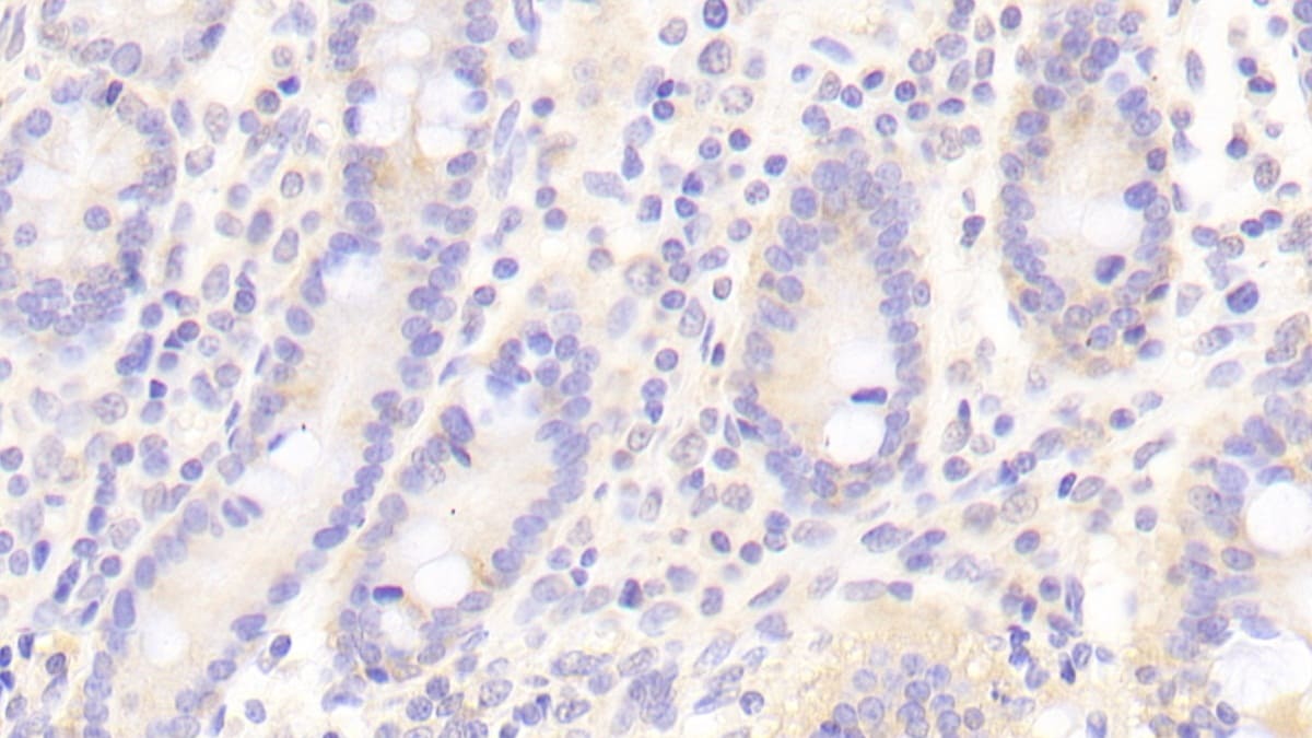 Fc gamma RIIIB/CD16b Antibody