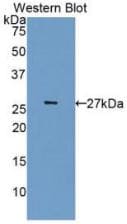 Cdk5 Antibody (3#)