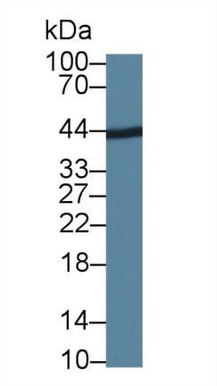 LIGHT/TNFSF14 Antibody (C1)