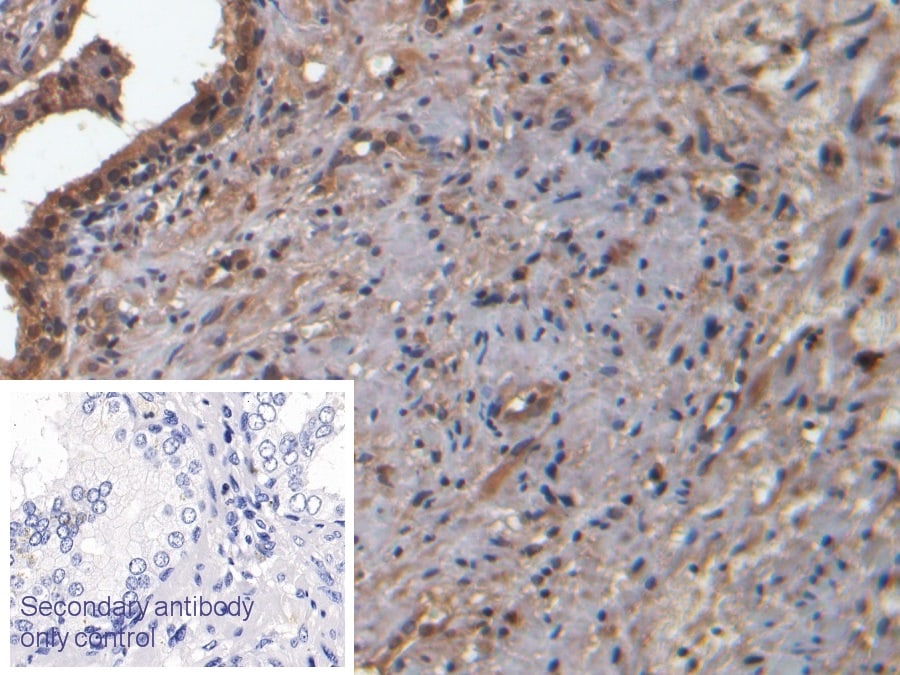 Muscarinic Acetylcholine Receptor M3/CHRM3 Antibody (C1)
