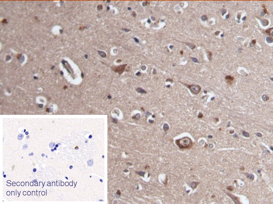 Muscarinic Acetylcholine Receptor M3/CHRM3 Antibody (C1)
