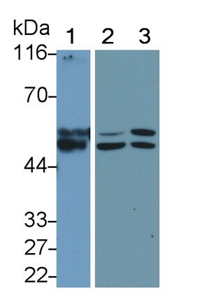 MMP-11 Antibody (5#)