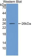MMP-11 Antibody (5#)