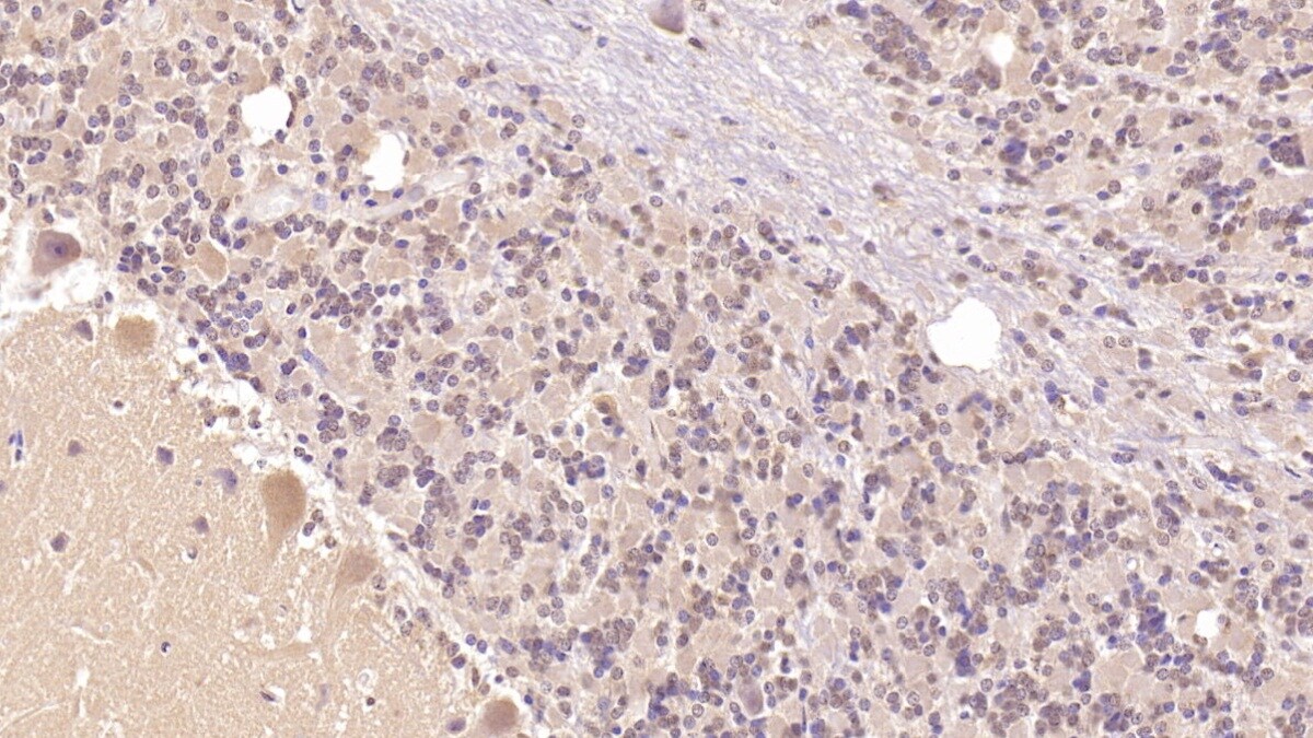 PTH2R Antibody (C1)