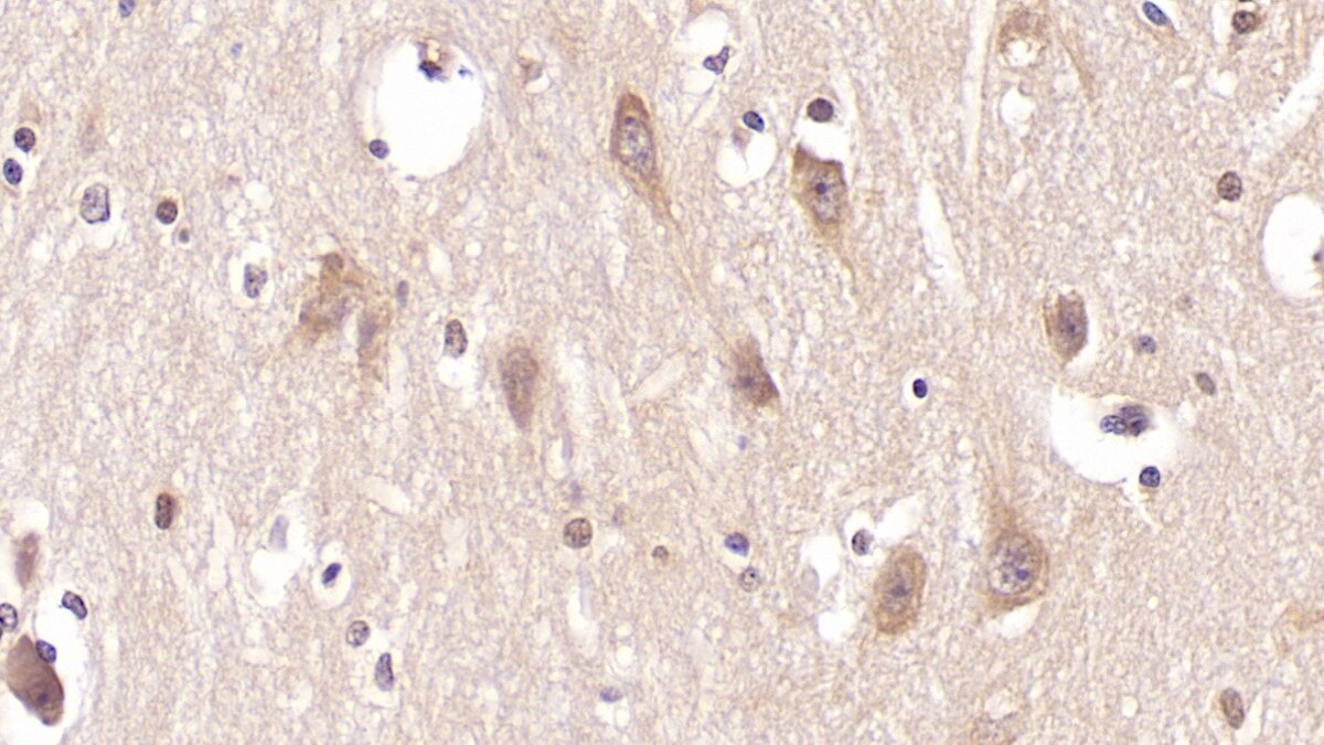 PTH2R Antibody (C1)
