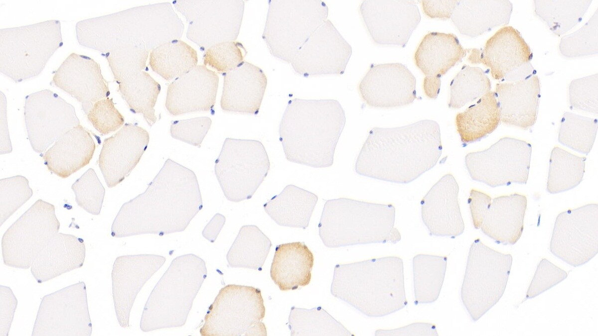 15-Lipoxygenase 1 Antibody (6#)