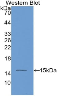 MASP2 Antibody (C9)
