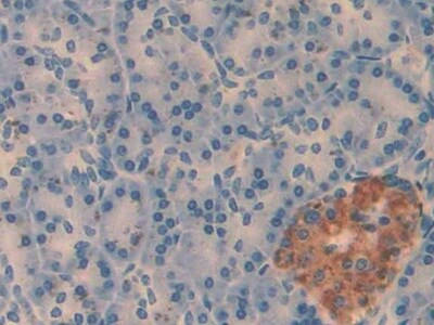 Amylin Antibody (C2)