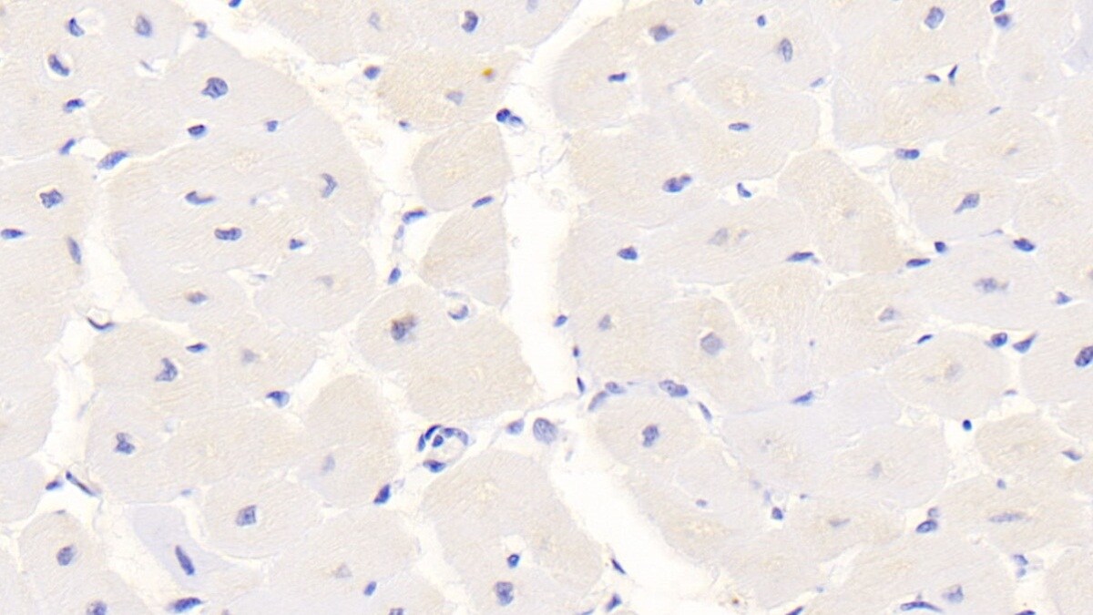 S100A/B Antibody (C8)