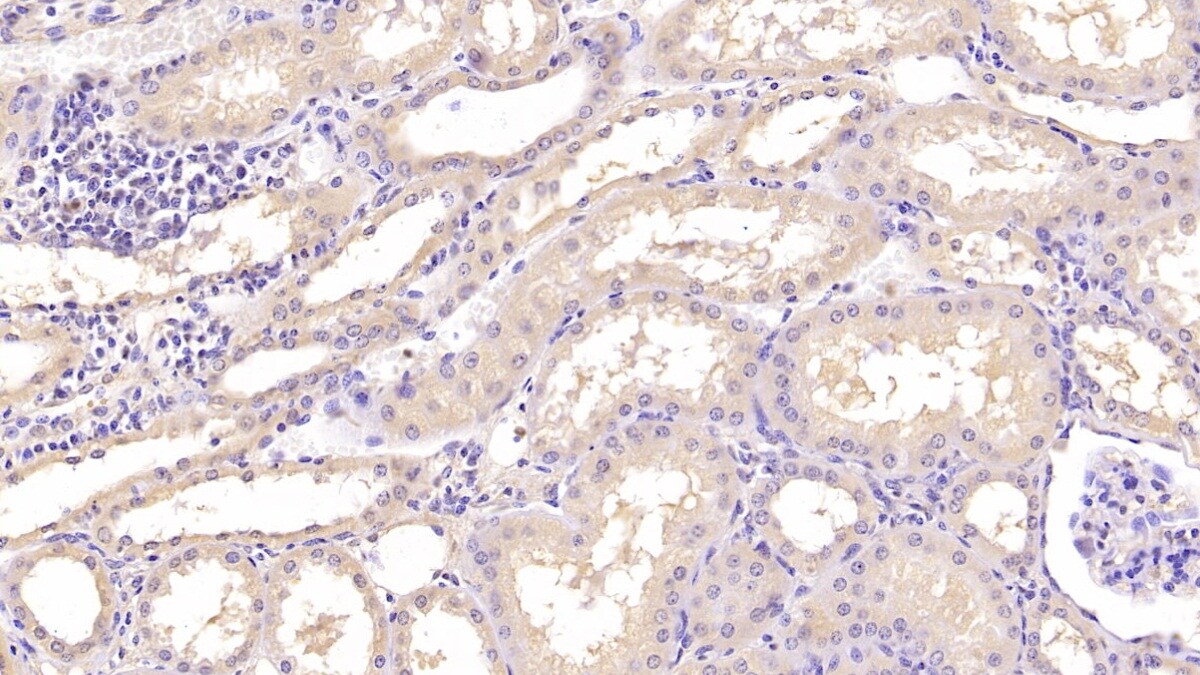 Annexin V Antibody (C13)