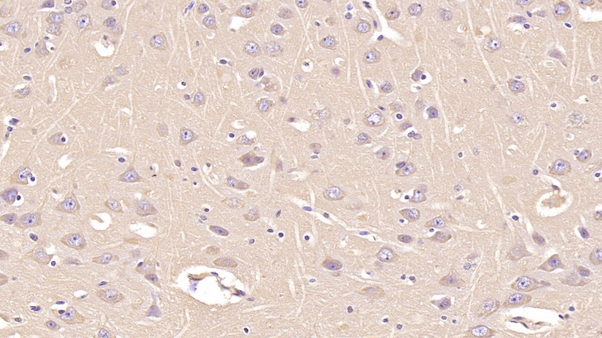 Annexin V Antibody (C13)