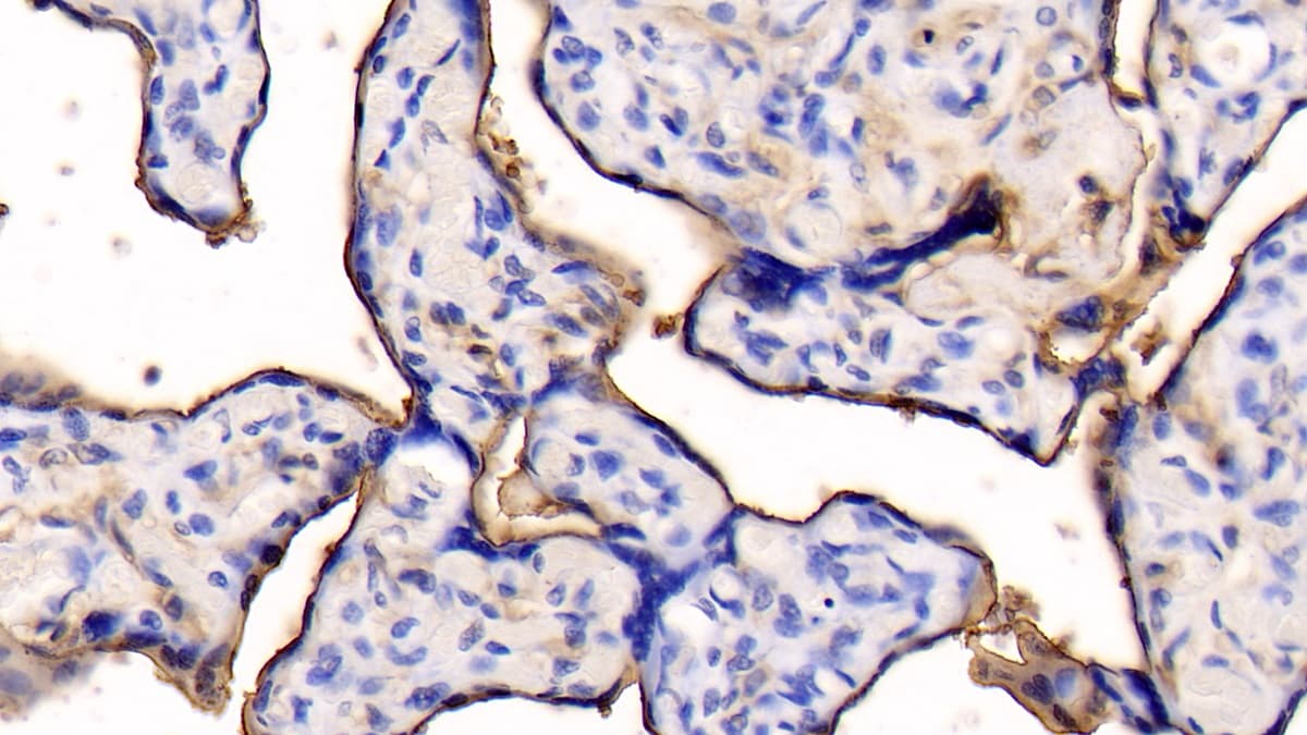 Annexin V Antibody (C10-1)