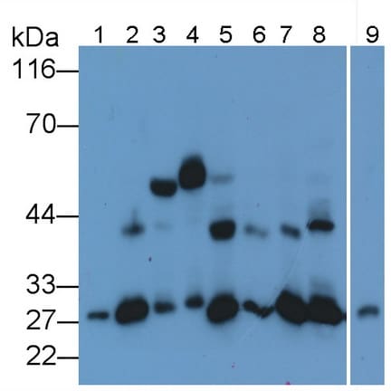 Cathepsin K Antibody (C1)