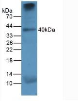 Cathepsin K Antibody (C4)