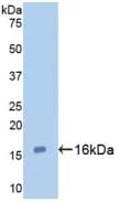 Galectin-7 Antibody (C2)