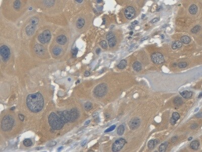 Galectin-7 Antibody (C2)