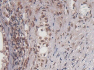 EGR1 Antibody (C11)